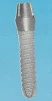 Star Vent Single Stage Screw - 2