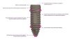 ESI-Essential Spectrum Implant-Conical Hex Connection Slim (3.0) - 3