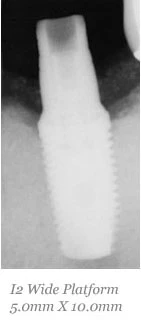 I2 Wide Platform (4.5)