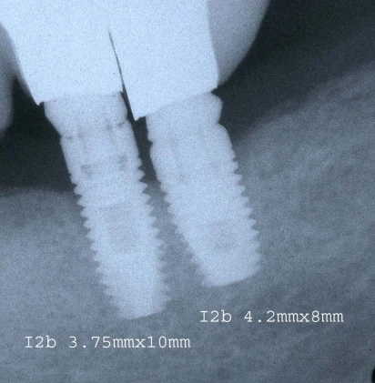 I2b Narrow Platform (3.75)