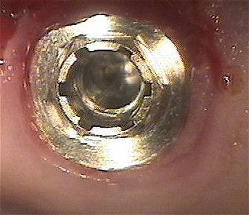External Hexagonal Cylindrical (4.1)