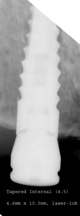 Tapered Internal (4.5)