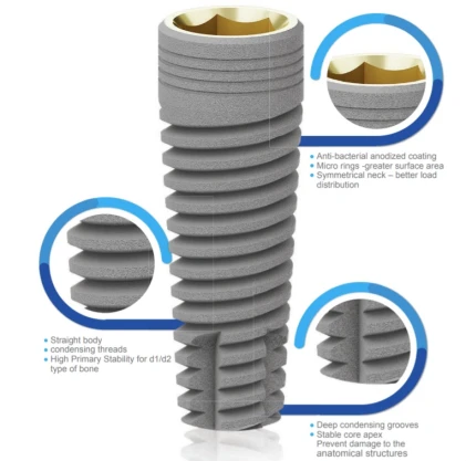 CDI Cylindrical Implant (3.5)