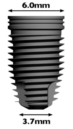 Two Stage Trilobe (5.0)