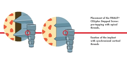 Frialit-CELLplus (3.4)