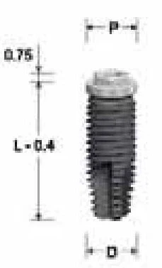 External FSN Regular (4.1)