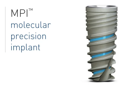 Molecular Precision Implant MPI