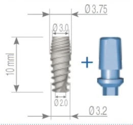 Ideal Titanium Implant (ITI) 2.1