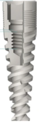 Nova Titanium Implant (NTI) 2.1