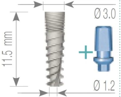 Nova Titanium Implant (NTI) 2.1