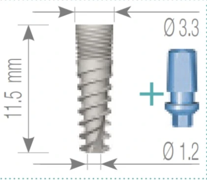 Nova Titanium Implant (NTI) 2.1