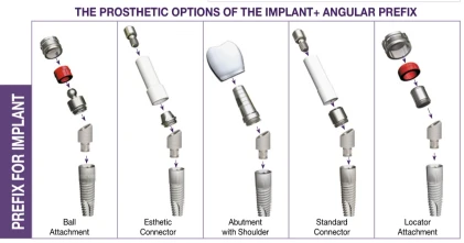 Ideal Titanium Implant (ITI) 2.43