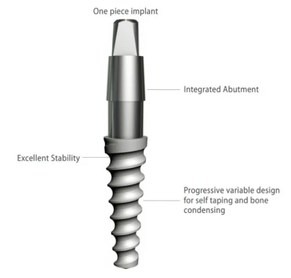 Solo Titanium Implant (STI)