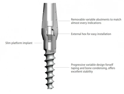 Solo Modular Titanium Implant (SMI)