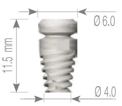 Unique Modular Titanium Implant (UMI) 2.43