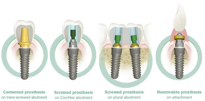 Naturall (Natura) (4.0,4.5)