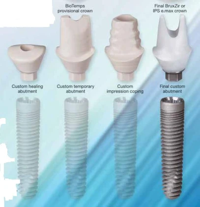 Inclusive Tapered (3.5)