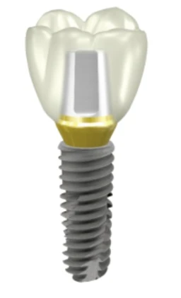 ET (TS) II SA Regular (2.5)