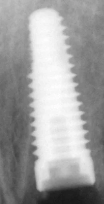 PrimaConnex Taper (WD)