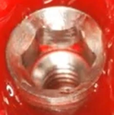 Paltop Active Implant PAI sp