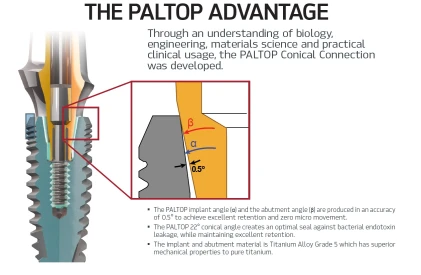 Paltop Conical Active PCA (2.1)