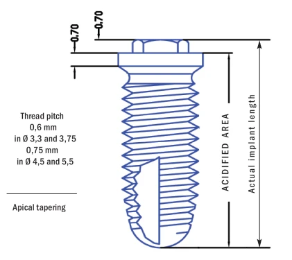 Cylindrical Implus None Polished Neck External Hex TTS (4.1)