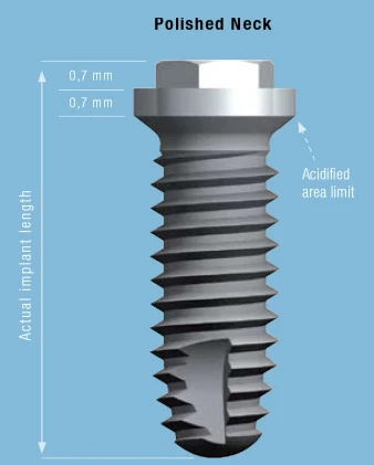 Cylindrical Implus Polished Neck External Hex (4.1)