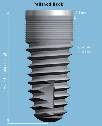 Cylindrical Implus Polished Neck Internal Hex (3.5)