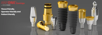 AnyOne Onestage (4.8)