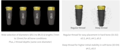 AnyOne Onestage (4.8)