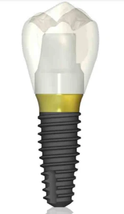 AnyOne Onestage (4.8)