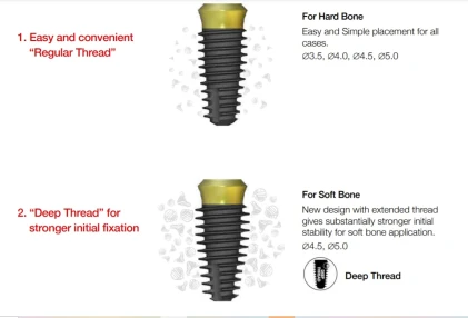 AnyOne Onestage (4.8)