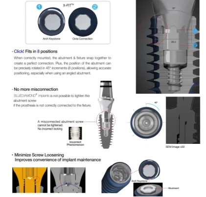 BLUEDIAMOND NC (AnyRidge Octa 1 NC)