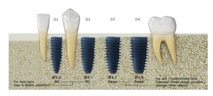 BLUEDIAMOND NC (AnyRidge Octa 1 NC)