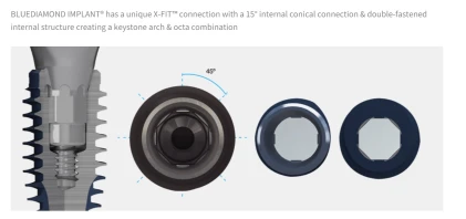 BLUEDIAMOND RC (AnyRidge Octa 1 RC)