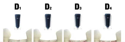 BLUEDIAMOND RC (AnyRidge Octa 1 RC)