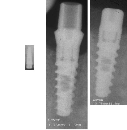 Seven Standard platform (3.75)