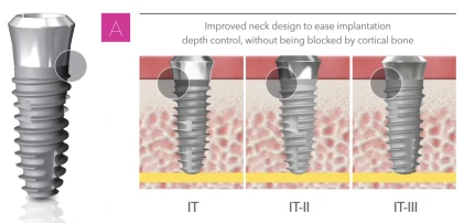 IT III active Regular Neck