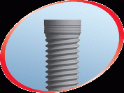 Nobel Replace - Straight NP (3.5)