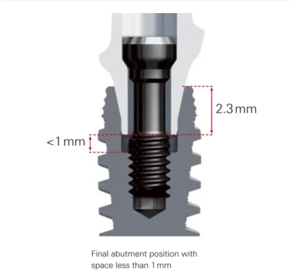 Nobel Active-Internal connection RP (5.0)