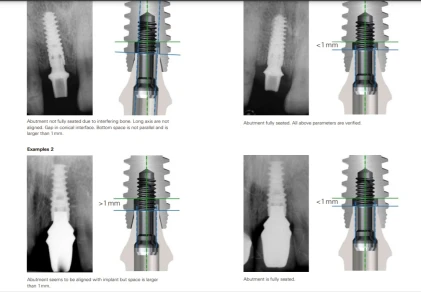 Nobel Active-Internal connection 3.0