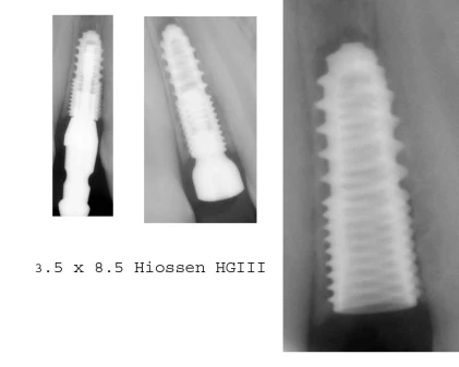 GS (HG) III Mini (3.5)