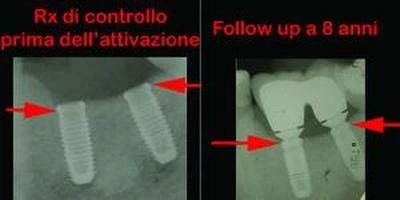 Physioplant Linea XL (5.0)