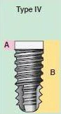 Type IV