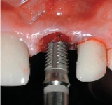 Internal Connection-Wide (6.2)