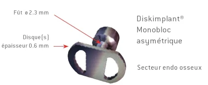 Diskimplant Monobloc Asymetrical