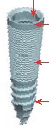 Fratex Internal Octagon