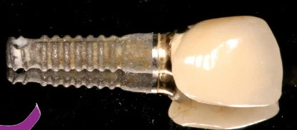 Micro-Vent SD (3.25) (Paragon)