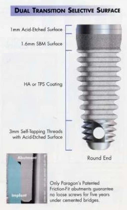 Micro-Vent Tapered WD (5.7) (Paragon)