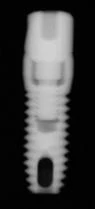 Screw Vent (3.5)